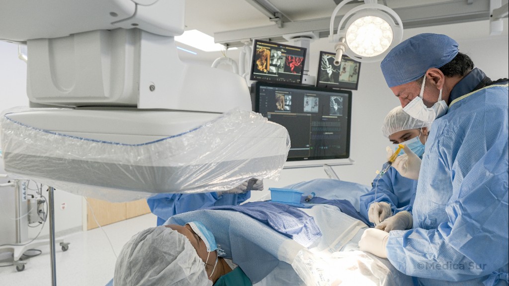 Intervención en Hemodinamia